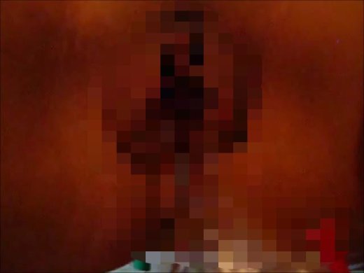 Amateurvideo Gynäkologenzange in der Pussy….Ton von JessundLaura